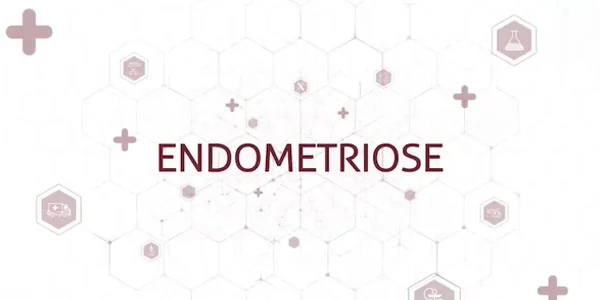 Endometriose: Diagnóstico correto por ressonância magnética garante tratamento eficaz