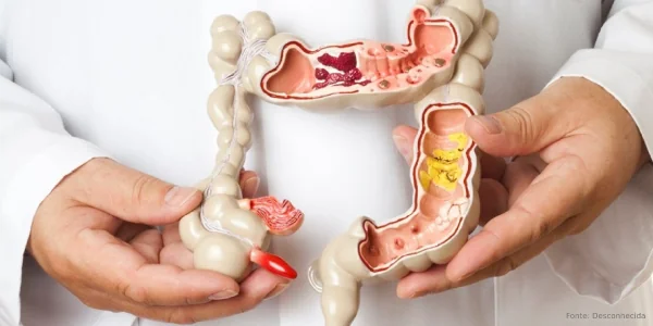 Março Azul-marinho: Diagnóstico precoce do câncer de intestino aumenta as chances de cura